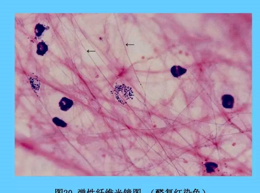 网状纤维染色分级图片