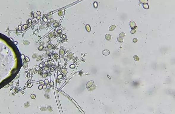 葡萄霜霉病菌形态图图片