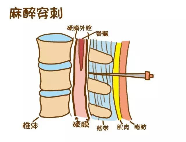 其它 正文腰椎和椎体上附着的 肌肉以及 韧带 都会受到 巨大的牵拉