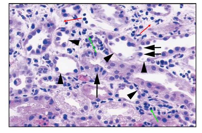 he染色:紅色箭頭:腎間質水腫;綠色箭頭:腎間質炎症細胞浸潤;黑色