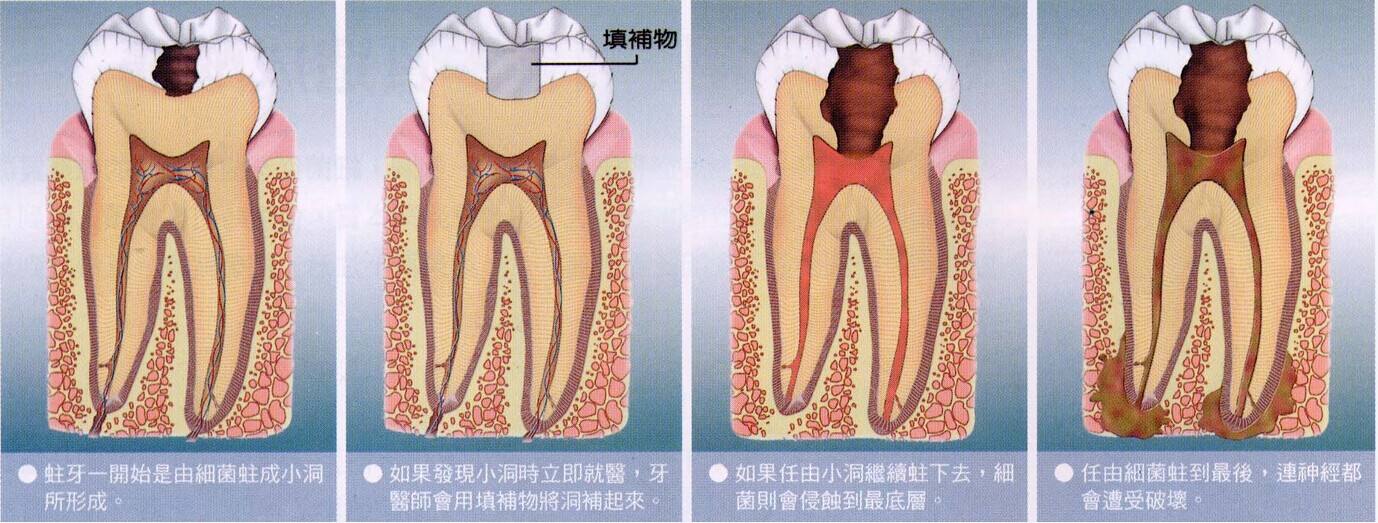 上海徐汇区哪里补牙不会疼