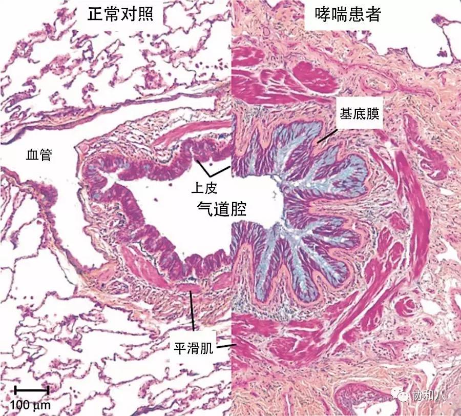 呼吸界的明星疾病哮喘一页手册协和八