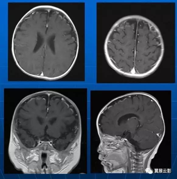 包含北京妇产医院靠谱核磁(MRI)到底有什么区别?的词条