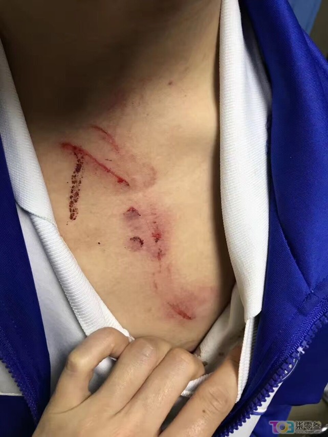 男生打架受伤帅气图片图片