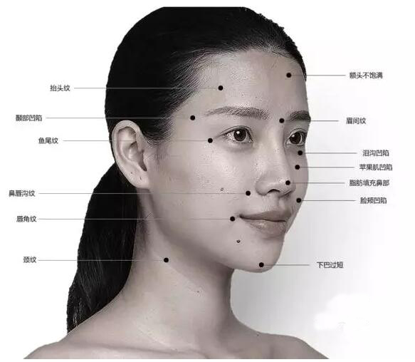 改善面部轮廓大部分是针对于年轻求美者