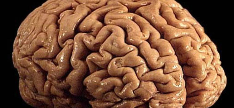 人类大脑 可怕图片