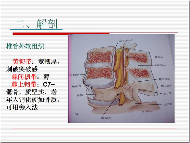 硬膜外麻醉解剖图图片