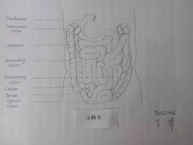 十二指肠手绘图图片