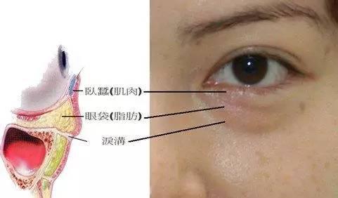 泪沟好难看!想要去除,你需掌握这项技能