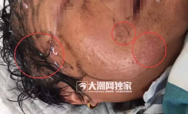 被挤成肉酱死人图片图片