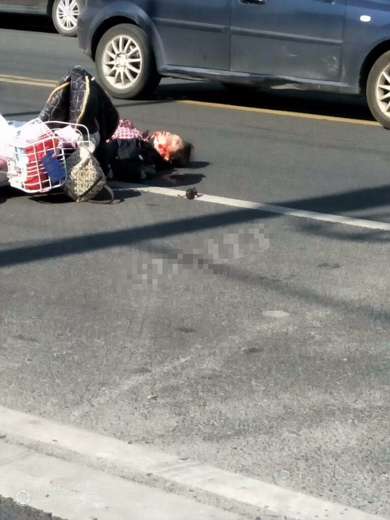 张浦花苑路曹巷附近出一交通事故,一位女子躺在地上满脸是血