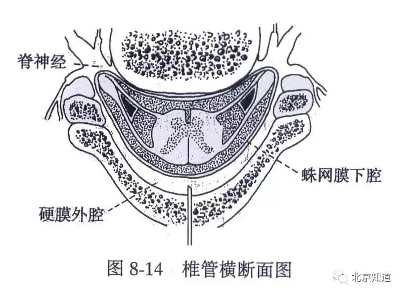 硬膜囊解剖图片