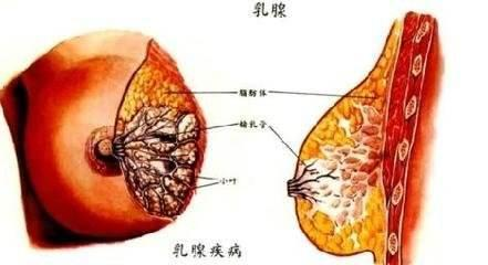 乳腺囊性增生病的治療方式