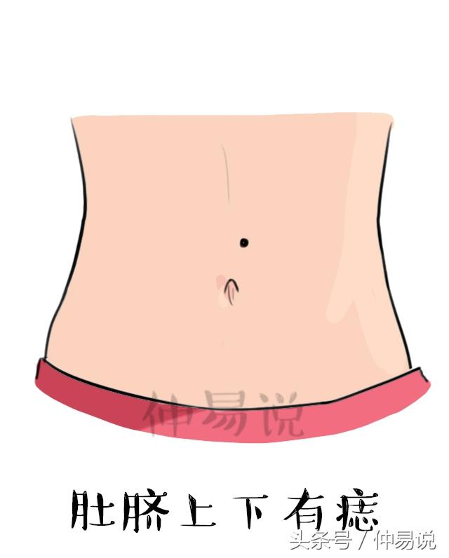 女腹部痣图片