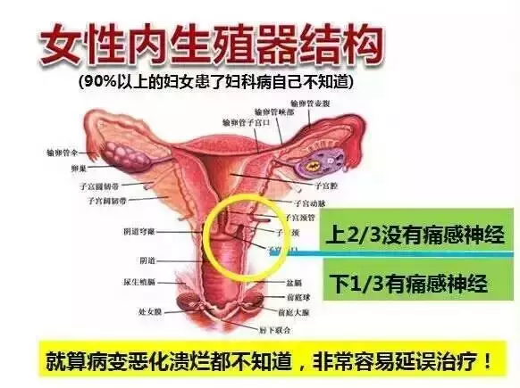 为什么中国女性妇科疾病发病率居全球首位