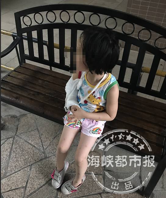 注意 福州5岁女孩滑下去后,当场骨折!一周两小孩中招!