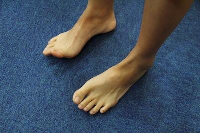 下床一踩地就足跟痛竟是因跑步导致足底筋膜炎