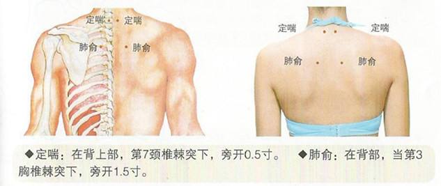 哮喘灸贴使用图图片