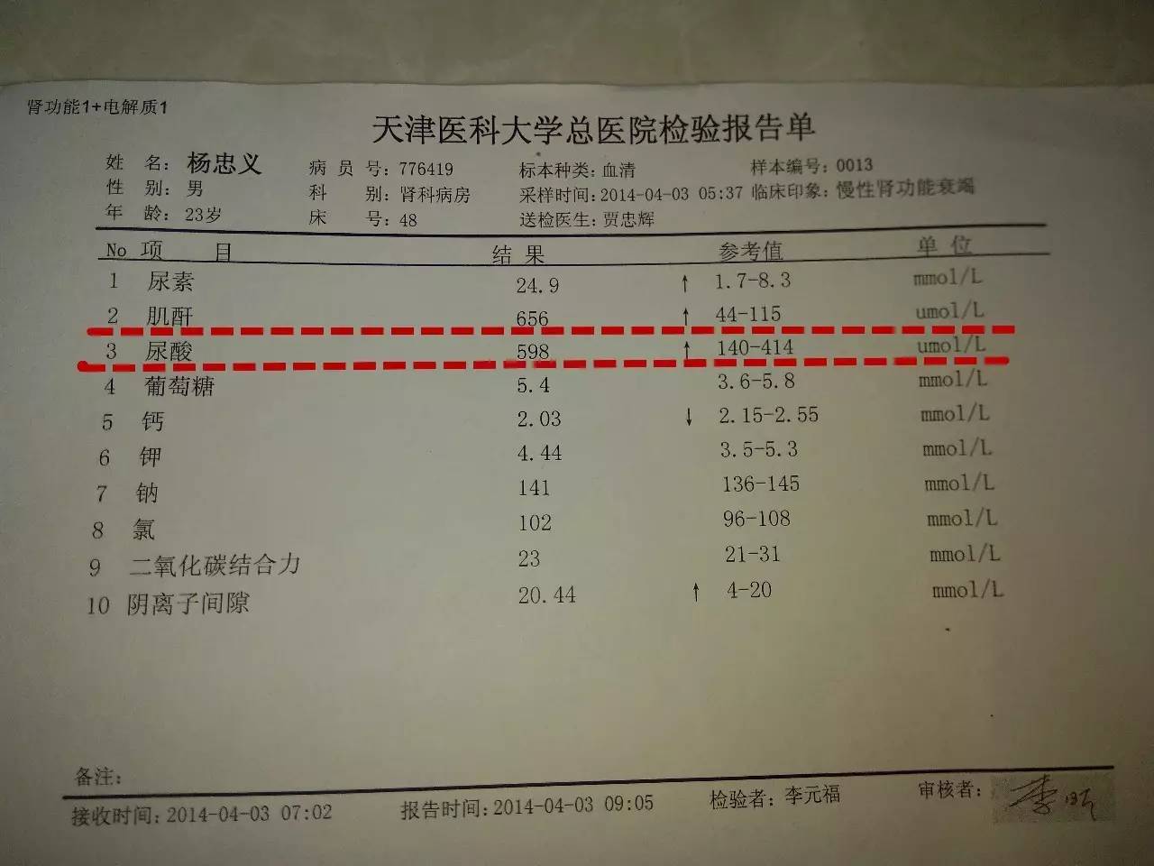 尿毒症化验单图片