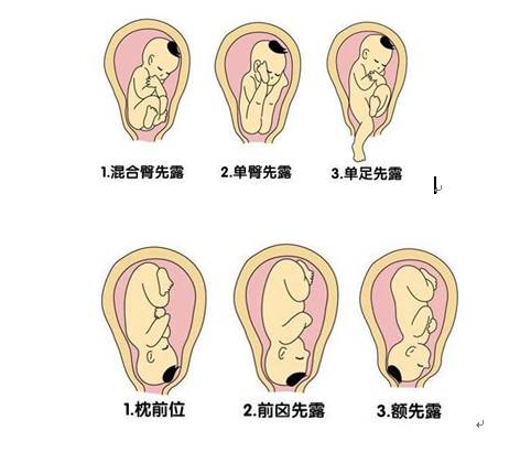 头位loa和lot区别图片图片