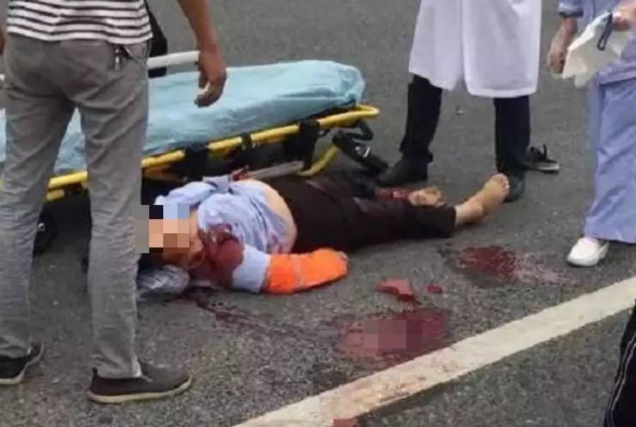 惨江东大道办事中心附近发生惨烈车祸女子左腿被压成两截血流不止