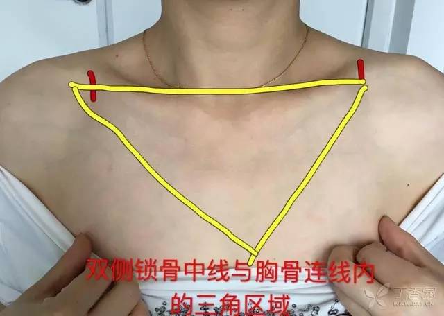 双侧锁骨中线与胸骨连线内的三角区域而腕指横纹上三横指(病人的手指