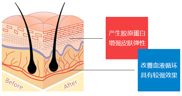 做线雕和不做线雕差距好大