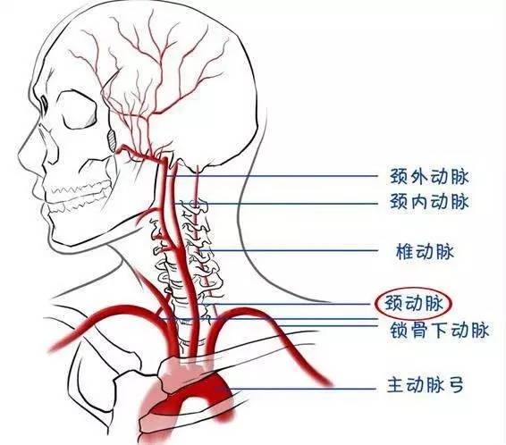 没有明显症状的颈动脉狭窄,需要治疗吗?