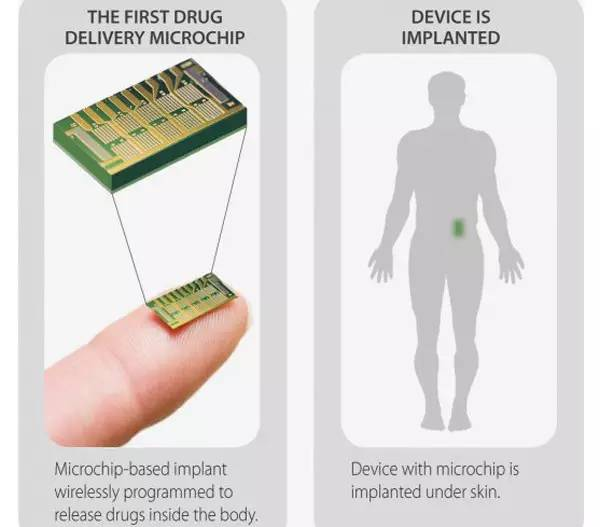 太恐怖盘点那些植入体内的智能可穿戴设备
