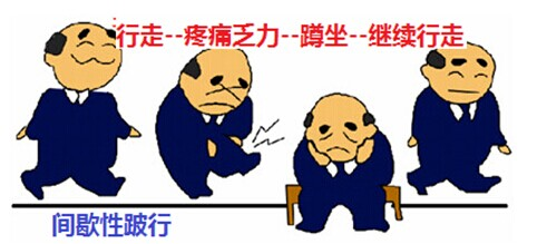 股骨头坏死漫画图片