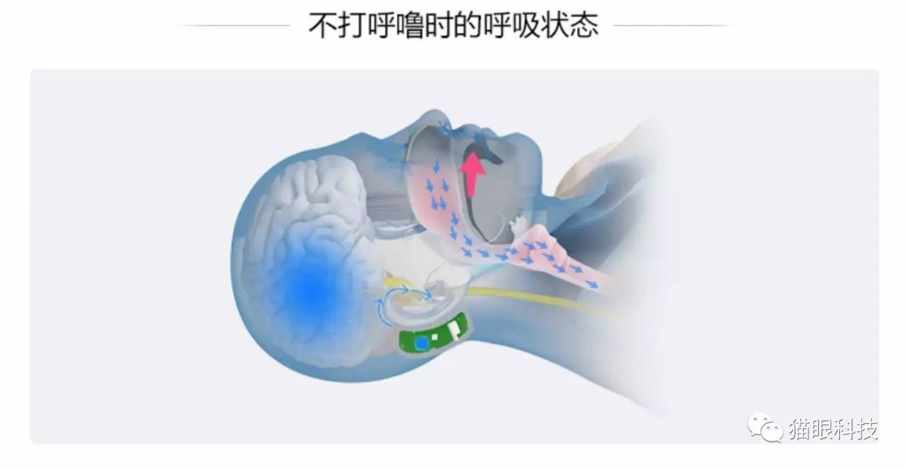 打鼾模拟图片