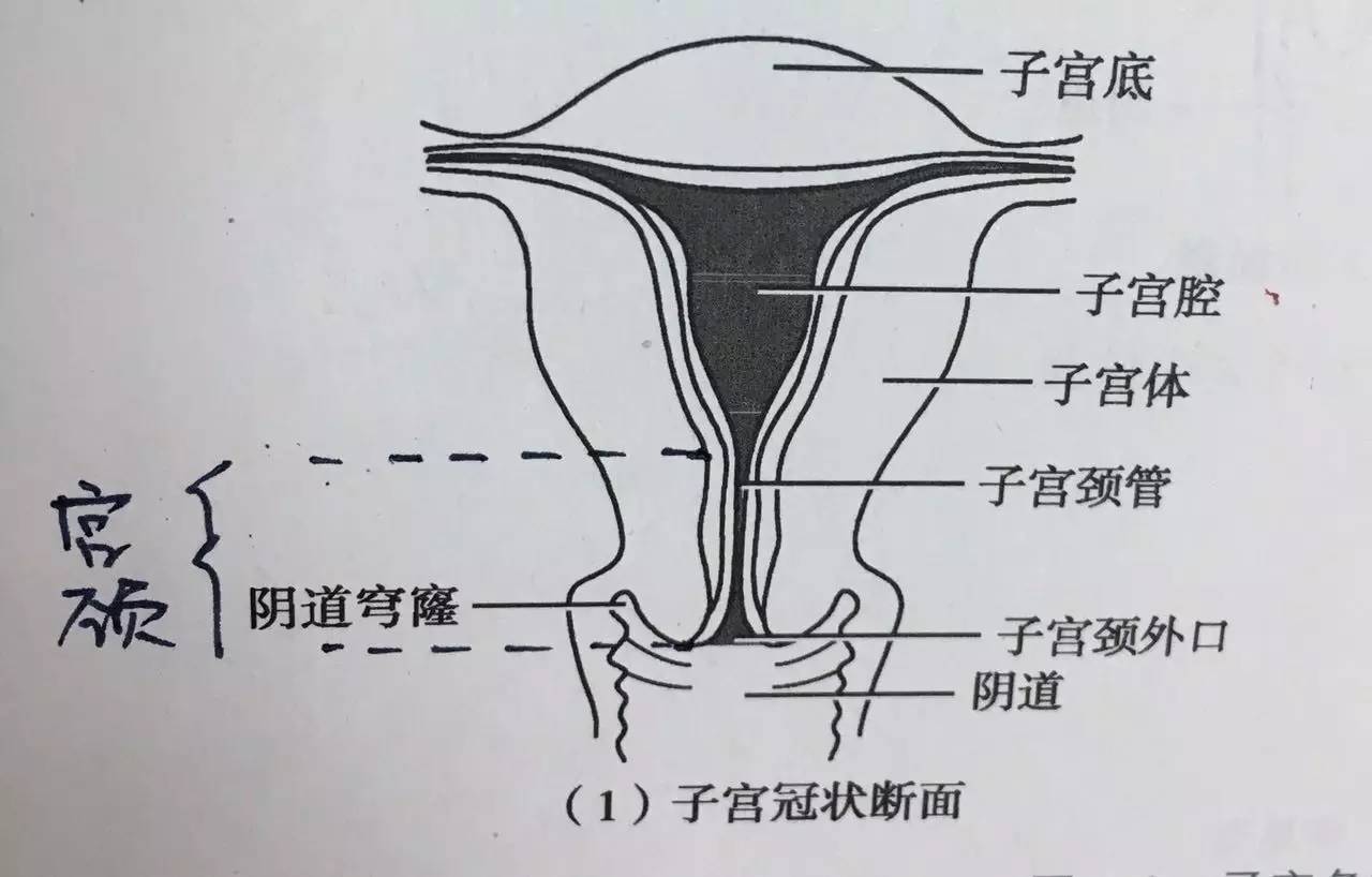 宫颈闭锁图片图片