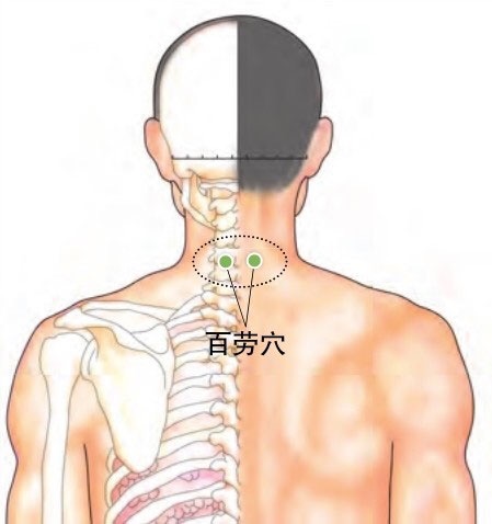 颈百劳的准确位置图的图片