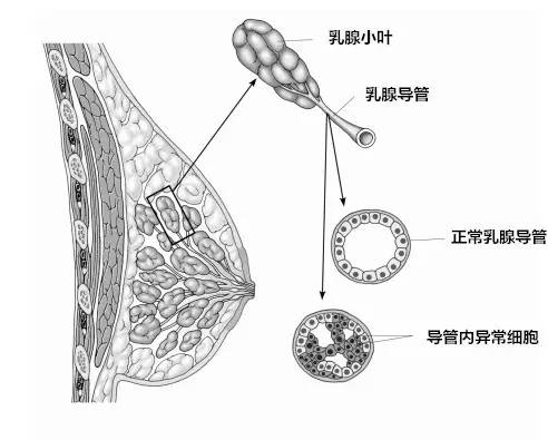 乳腺大导管构造示意图图片