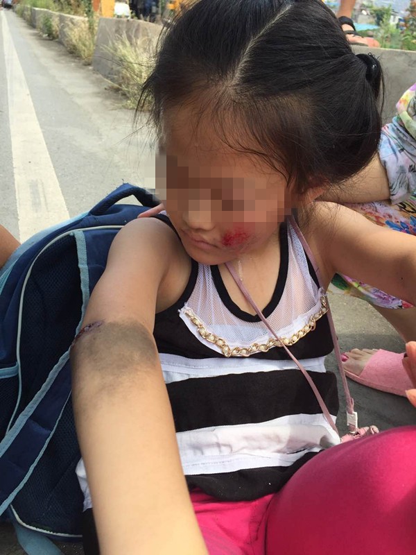今天中午南山附近一小女孩被越野车撞伤暑假来了千万看好孩子
