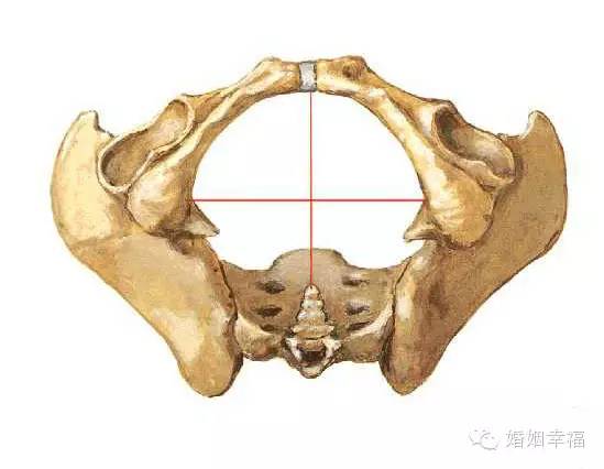 中骨盆平面狭窄图片