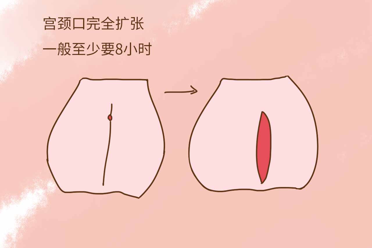 二,宫颈口的扩张只有强烈的宫缩阵痛后,宫颈口才能逐渐打开