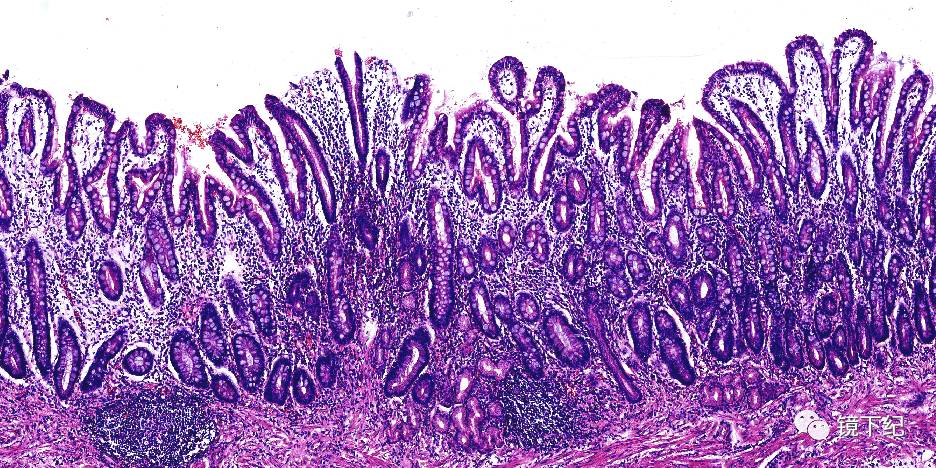 胃粘膜组胚图图片