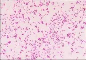 弯曲杆菌显微镜图片图片