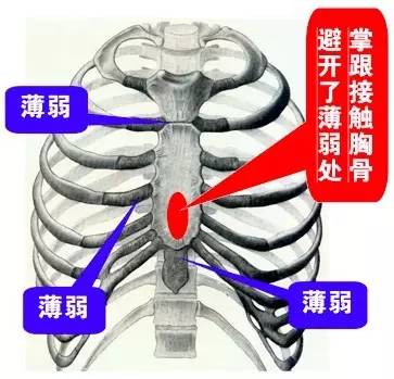 图 1 按压手法:仅掌根接触患者胸壁但是,在实际操作时,按压者无法至始