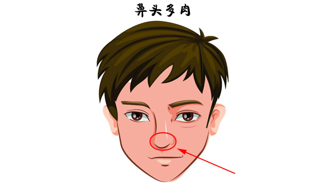 鼻头多肉在面相学中