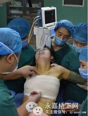 隆胸手术模拟器图片