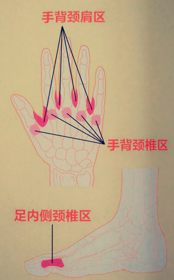 步驟1:用垂直按揉法按揉手背頸椎區,頸肩區,尋找痛點,重點按揉.