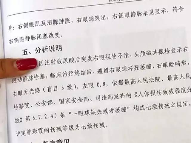 贛州司法鑑定中心出具的傷殘程度司法鑑定意見書顯示,小美的傷殘等級