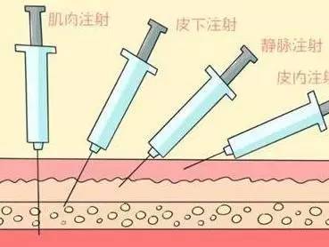 卡介苗肌肉注射图片