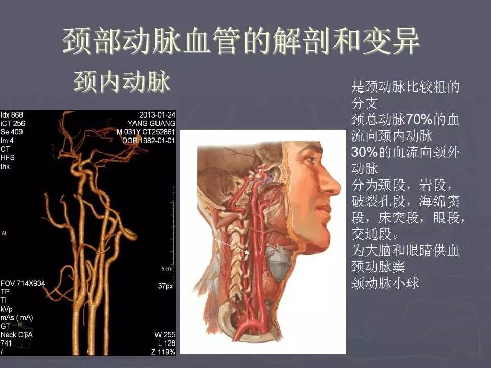 头颈血管解剖和CTA图片