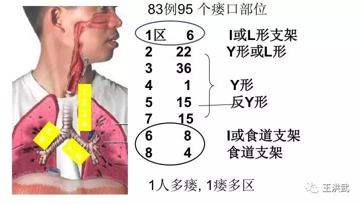 氣管竟與食管相通?