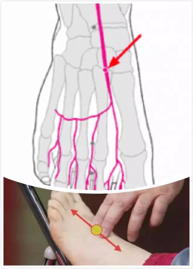 方法:用手指轻触脚背部靠近脚踝处的足背部动脉,感觉足背动脉有无搏动