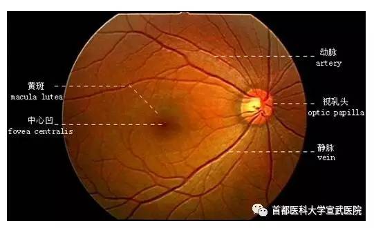 正常人的视网膜照片图片