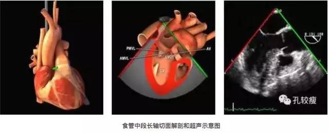 手把手教你做经食管超声心动图精美图文教学